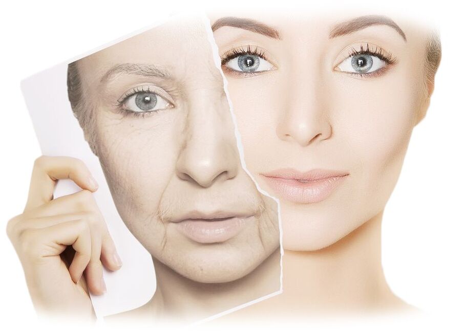 How does intenskin cream work for facial skin regeneration