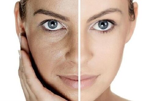 Calling the skin with their own blood plasma