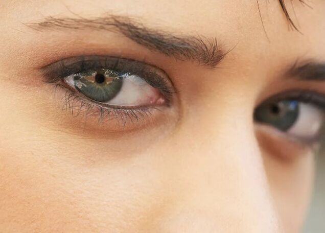 The dark circle under the eyes