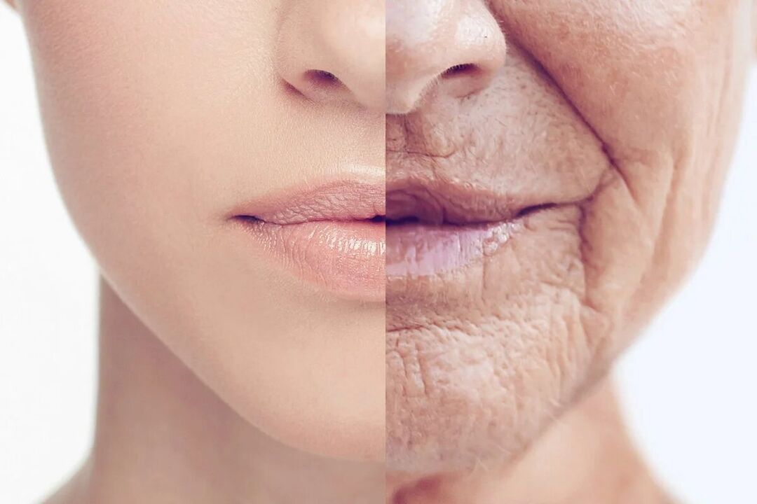 Deterioration of the skin with age