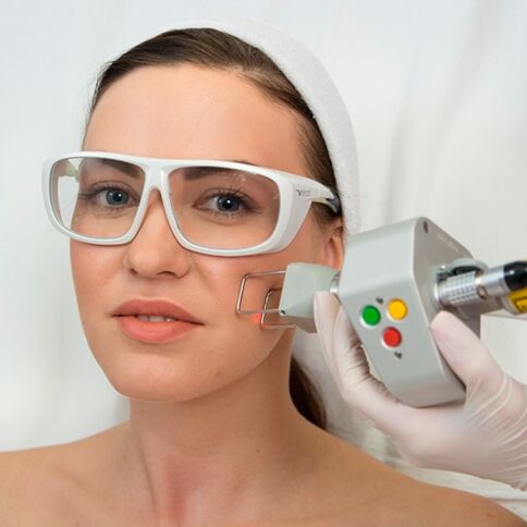 Fractional laser rejuvenation procedure that removes fine wrinkles
