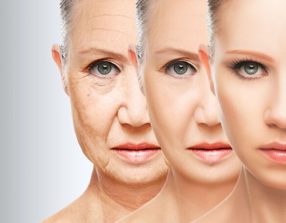 The process of removing facial wrinkles thanks to plasma rejuvenation